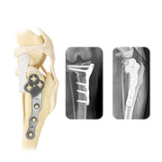 Veterinary TPLO Plate Dog 2.4mm Titanium Multi-Axial Locking Type for Canine Surgery - xcvet.com