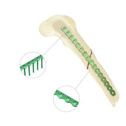 2.0mm Veterinary AO Orthopedic Implants Titanium Reconstruction Locking Plate - xcvet.com