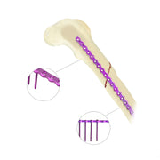 Veterinary 2.7mm AO Reconstruction Locking Plate Premium Ortho Implant - xcvet.com