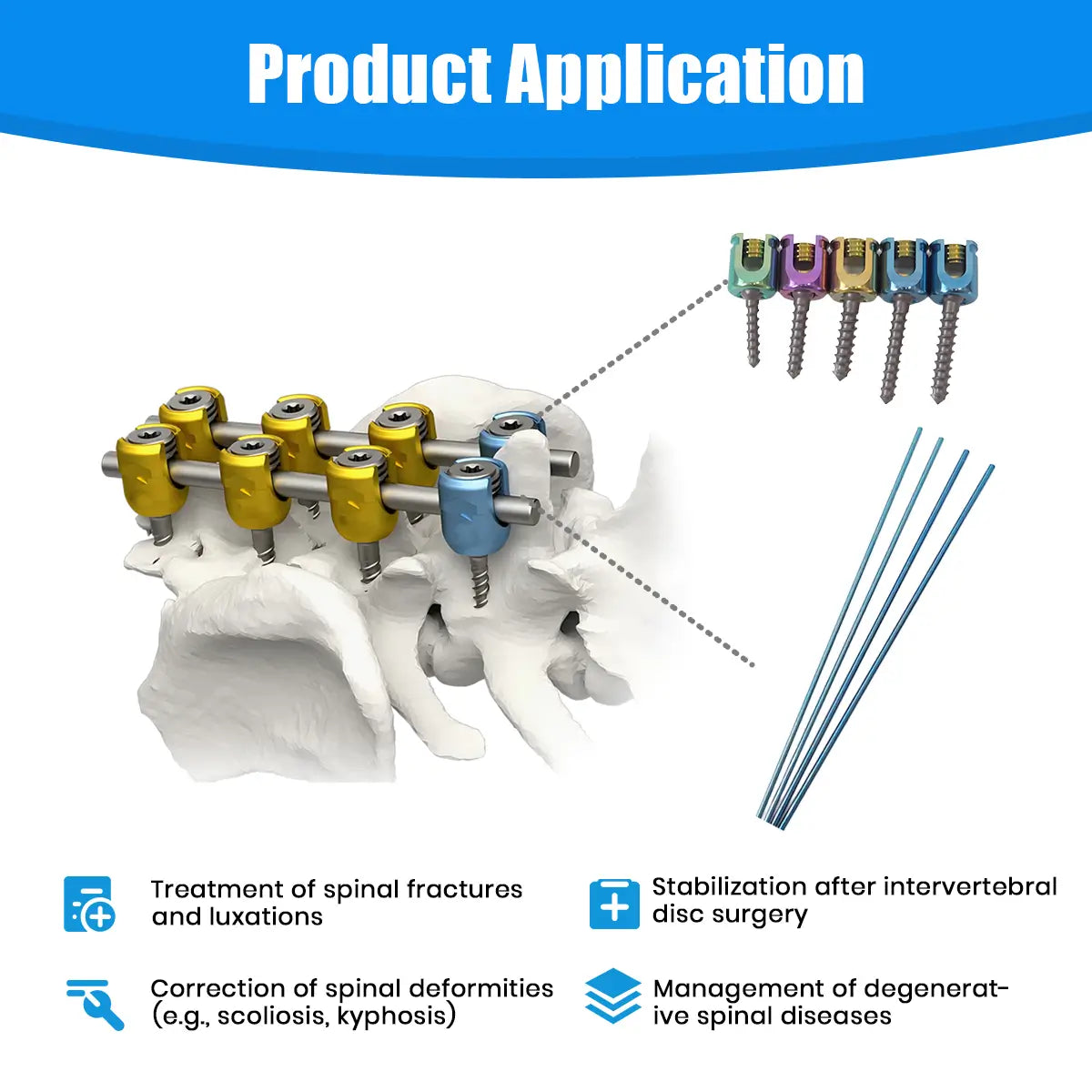 Titanium Veterinary Polyaxial Spinal Screws for All Animal Sizes - xcvet.com