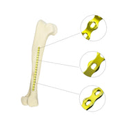 Veterinary 4.0mm ALPS Locking Plate, 1 Piece, 18/20 Holes, Premium Stainless Steel - xcvet.com