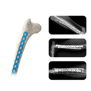 Veterinary 2.4mm ALPS Titanium Locking Bone Plate for Animal Orthopedic Surgery (1pc) - xcvet.com