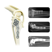 Canine 2.7mm Titanium Multi-Axial TPLO Plate for Stable Knee Reconstruction - xcvet.com