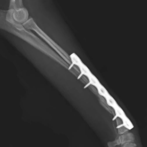 Long Bone Correction and Fracture Fixation