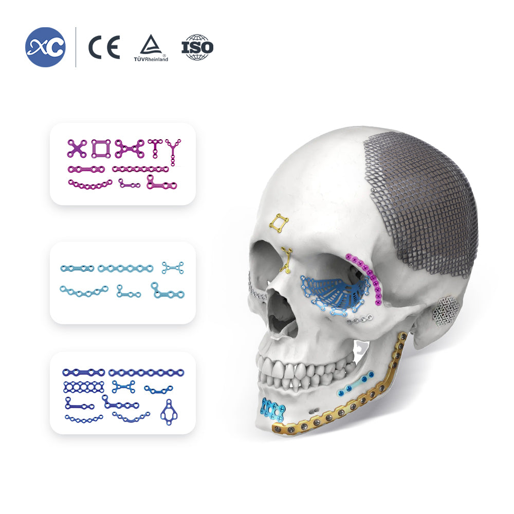 Φ1.5 / Φ1.8Screw for Maxillofical Non Locking Plate