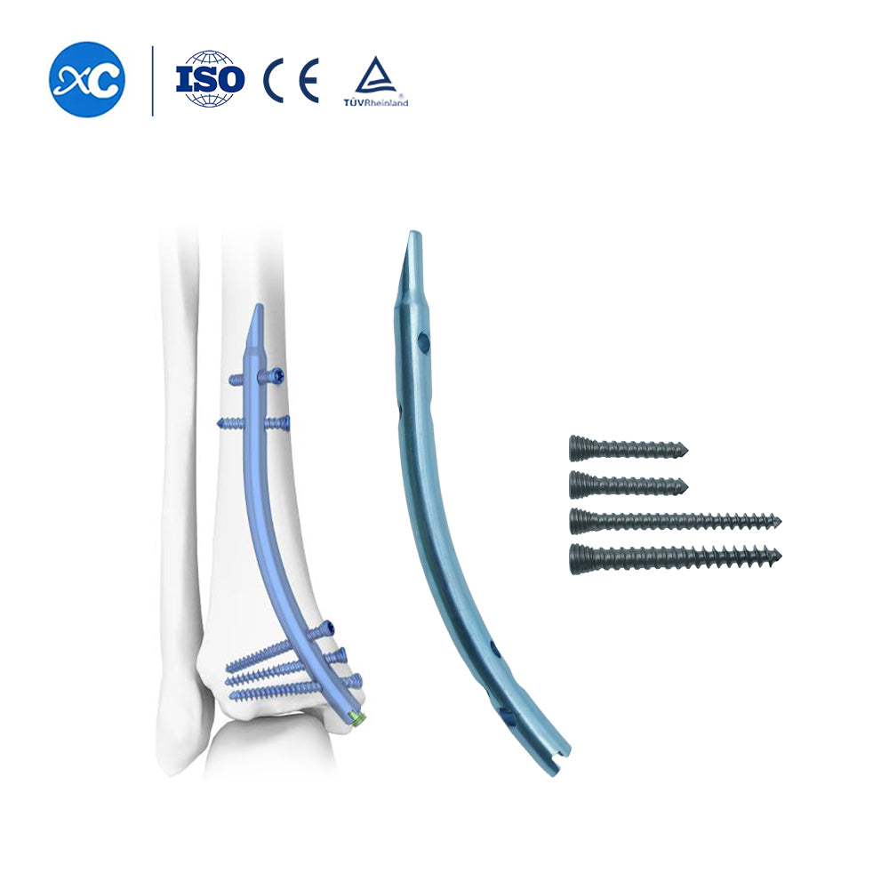 4.0 Locking Screw-I -II for Distal Tibial Nail