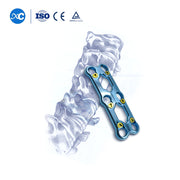 Anterior Cervical Plate-III-Anterior Cervical Plate System