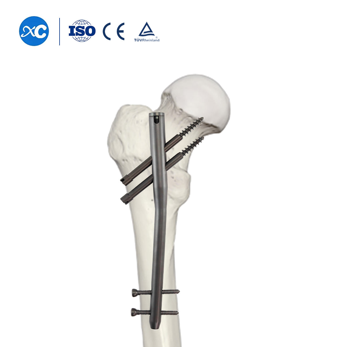 4.5mm Locking Screw Full-threaded for Gamma Intramedually Nail