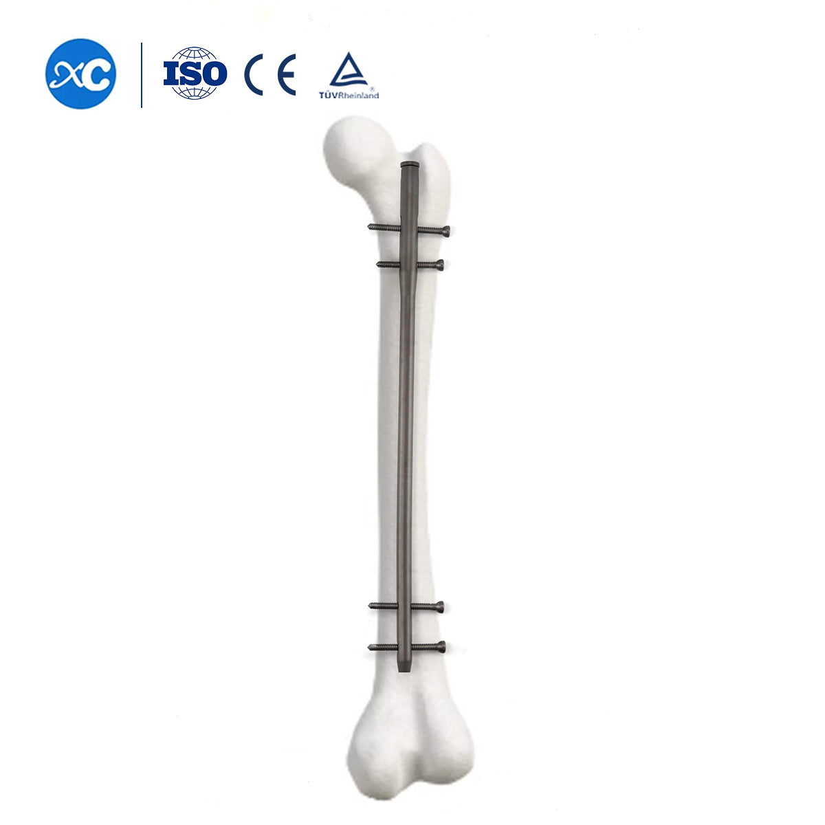 Femoral Reconstruction Intramedually Nail Match 4.5mm Locking Screw 6.5mm Locking Screw Full-threaded