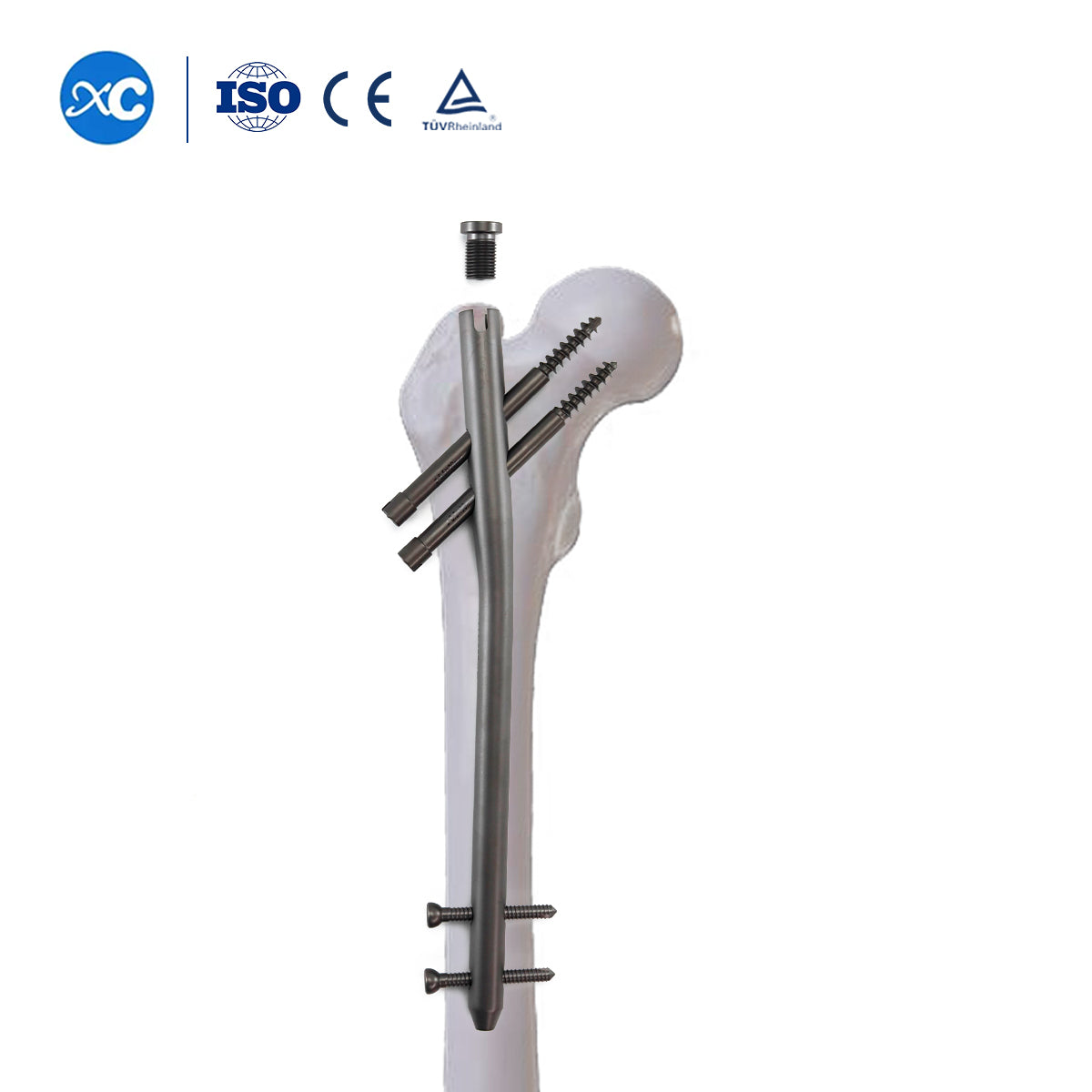 6.5mm Locking Screw Full-threaded for Gamma Intramedually Nail