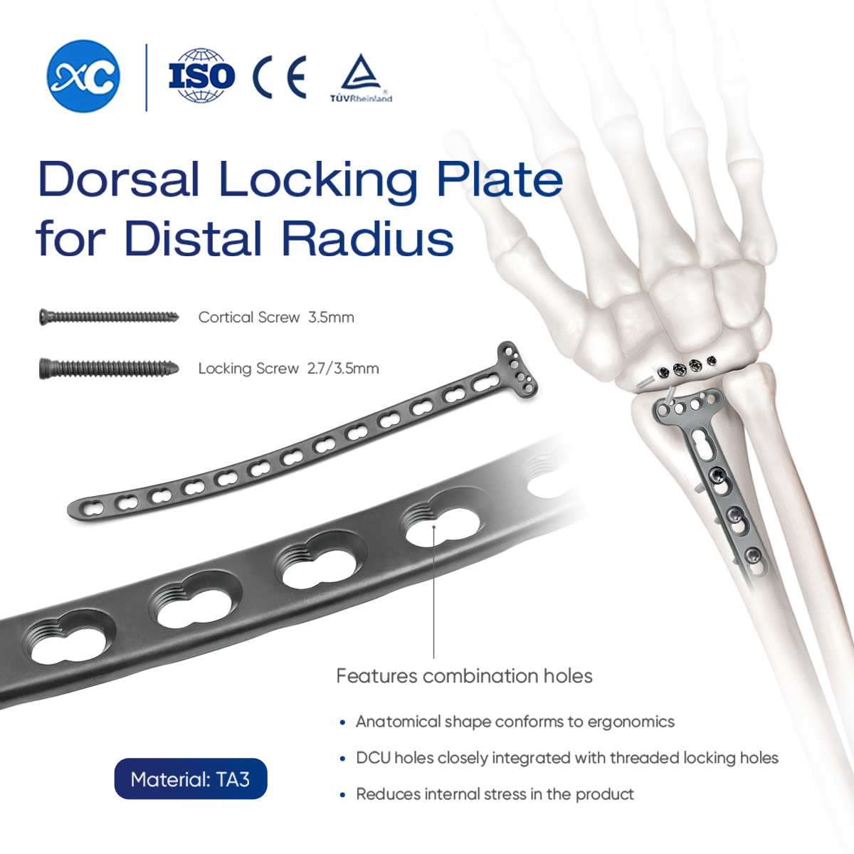 Dorsal Locking Plate for Distal Radius