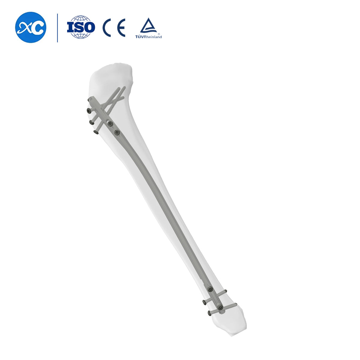 4.8mm Locking Screw for New Tibia Intramedullary Nail Locking Screw