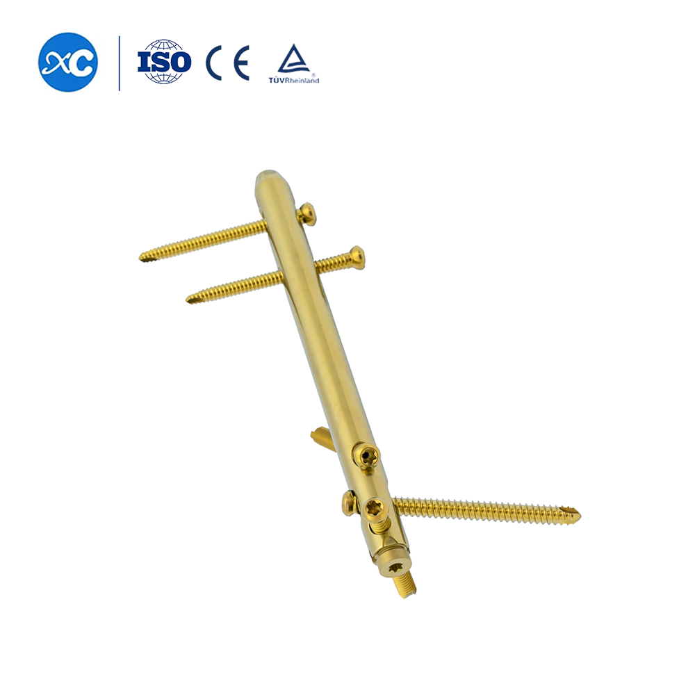 Hindfoot Fusion Ankle Nail