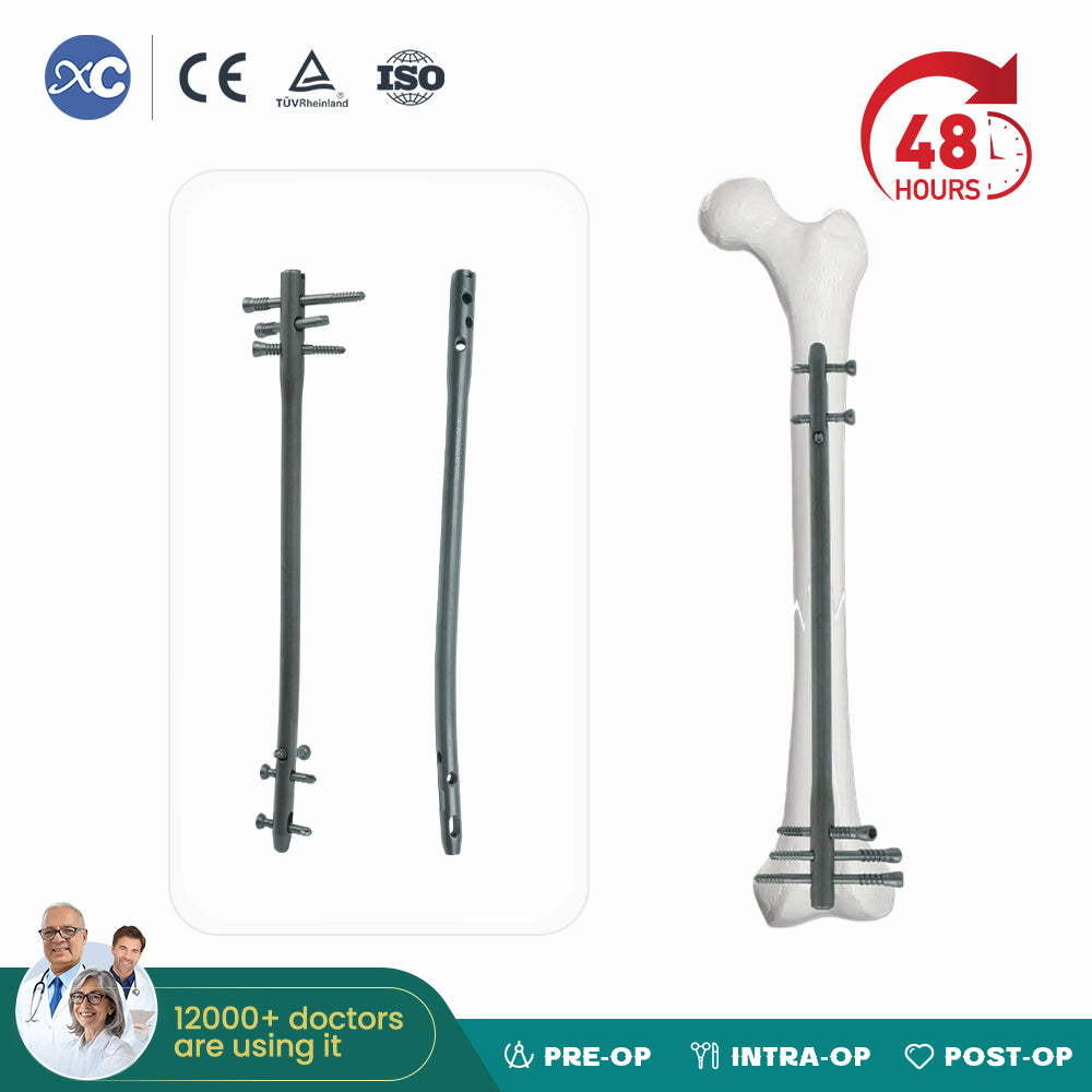 Femoral Reverse Intramedullary Nail-II