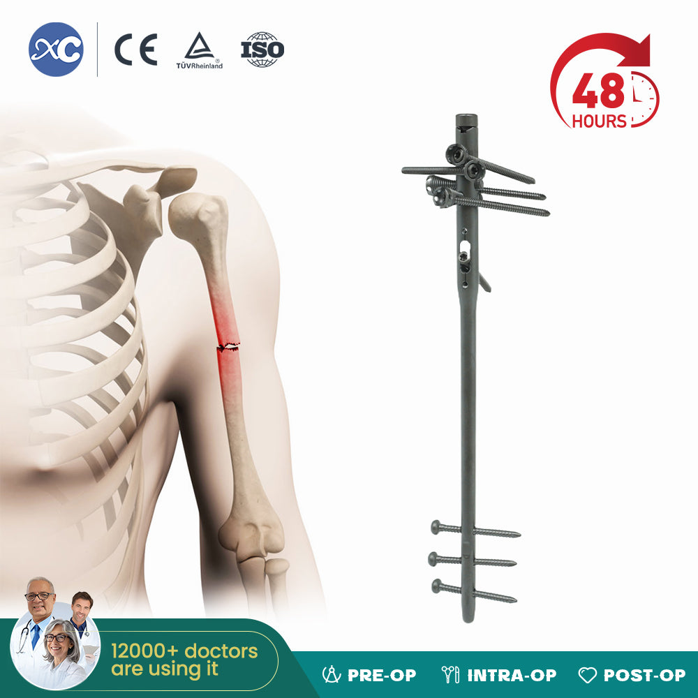 Humerus Multi Lock Intramedullary Nails
