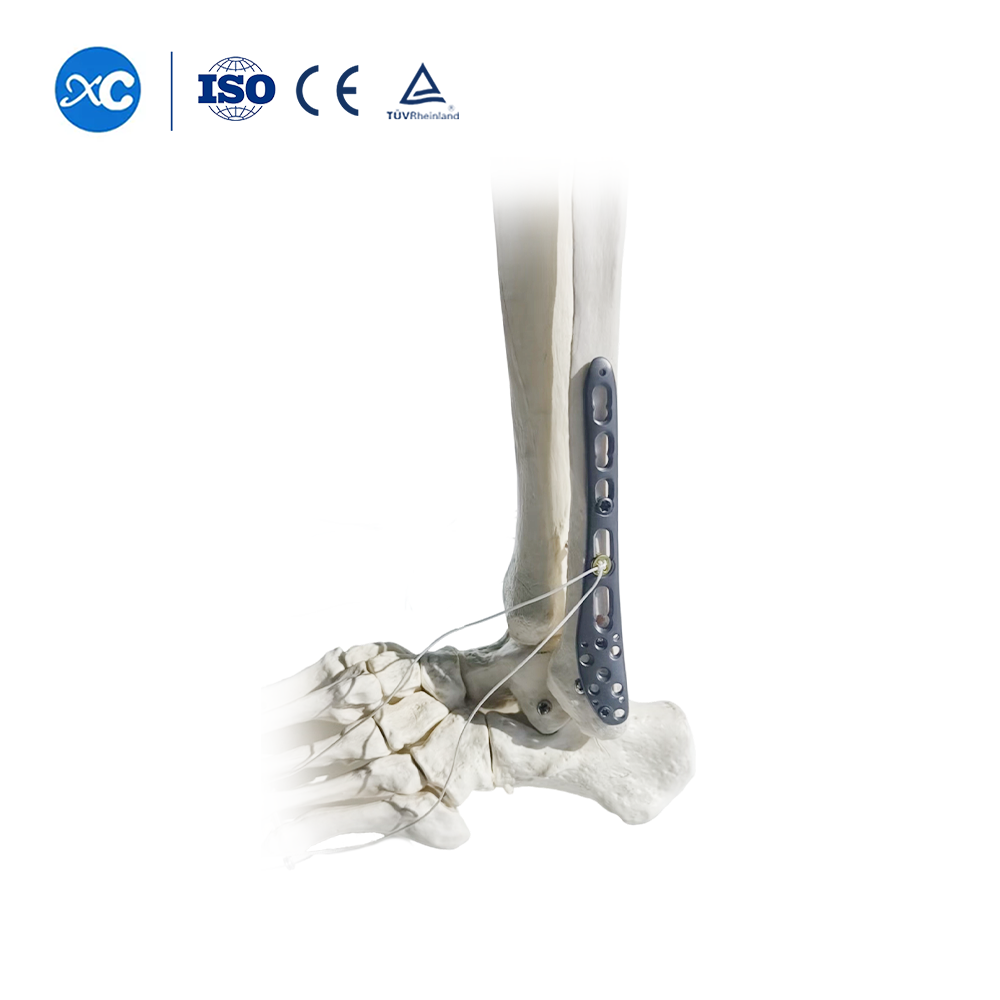 Locking Plate III for Distal Tibiofibular Syndesmosis Ⅲ