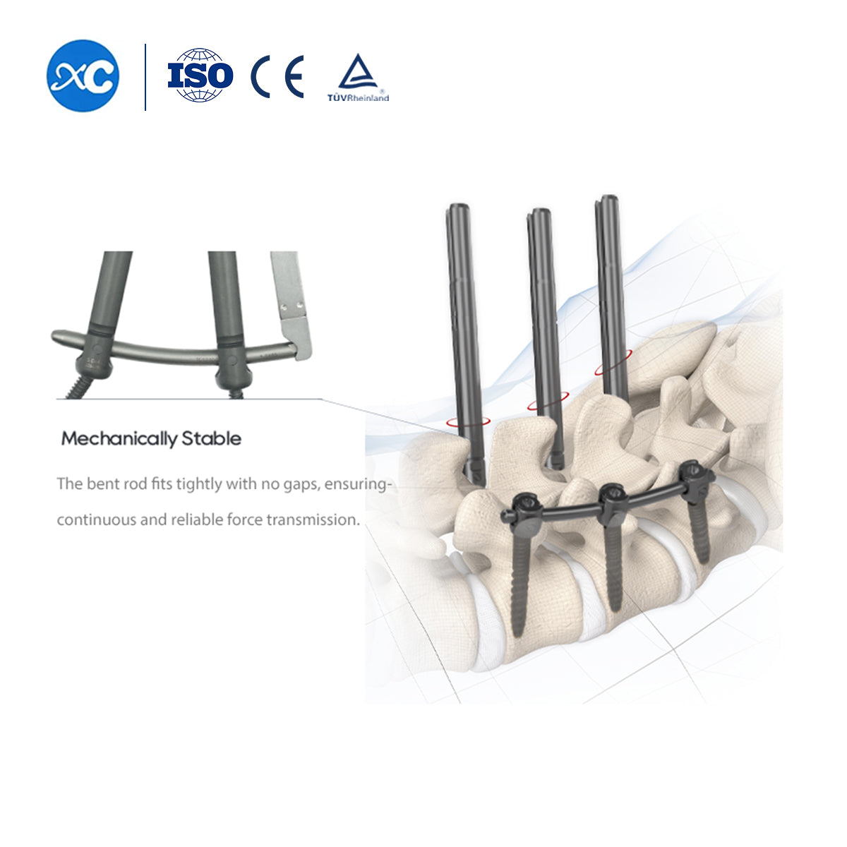 5.5 MIS Spinal System Il Pedicle Screw