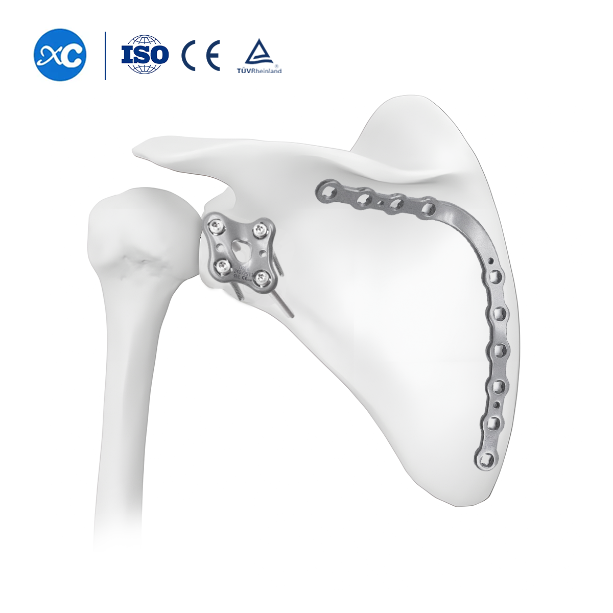 Arc Scapula Medial Reconstruction Locking Plate