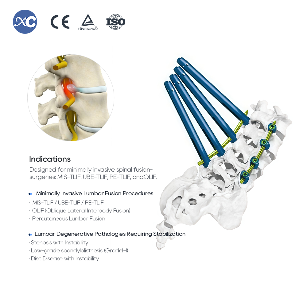 5.5 MIS Spinal System II Instrument Set
