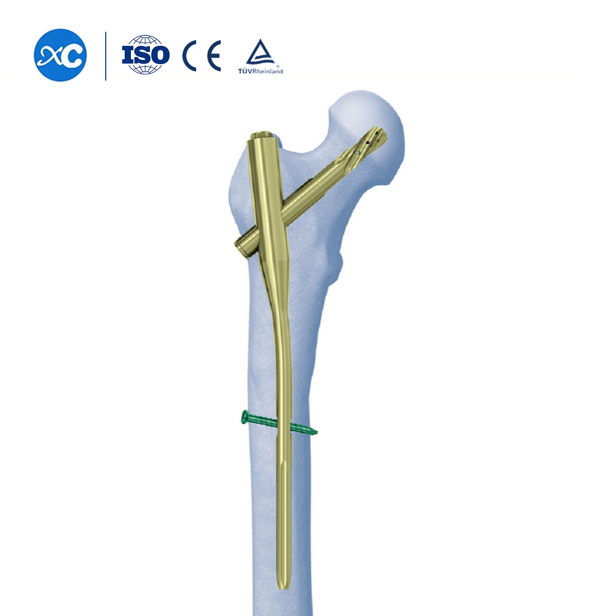 Blade Screw for PFNA(Gama) Intramedullary Nail