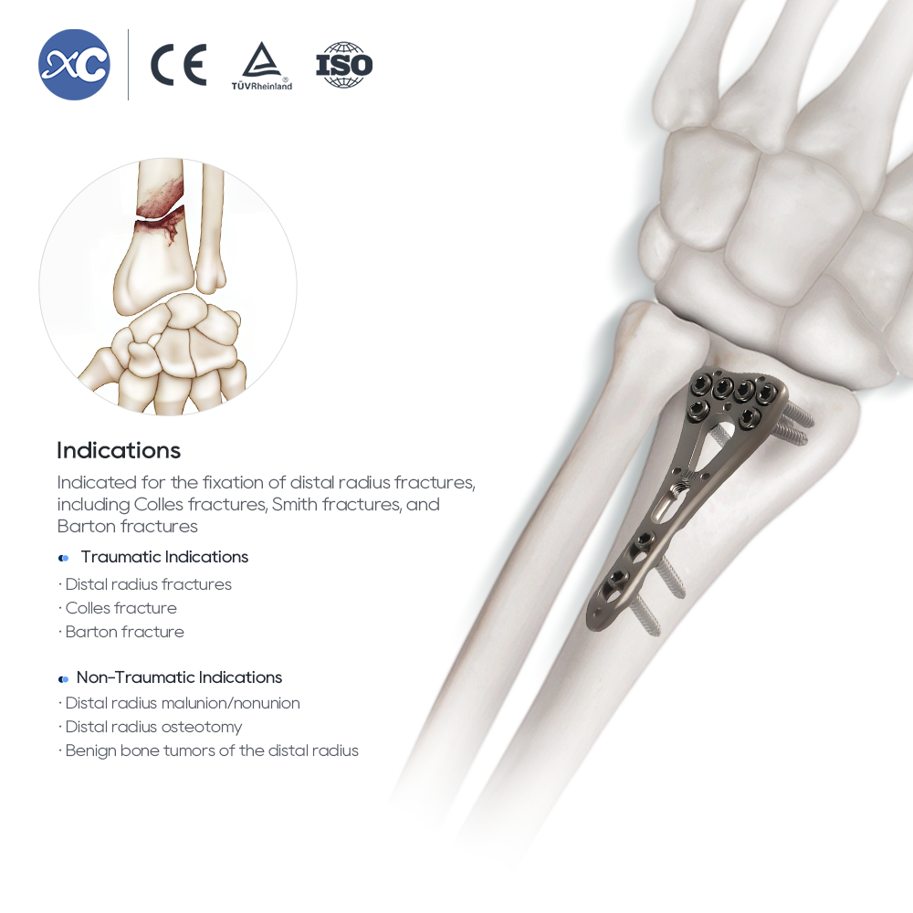 Distal Radius Instrument Set
