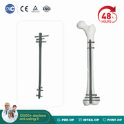 Femoral Reverse Intramedullary Nail-II