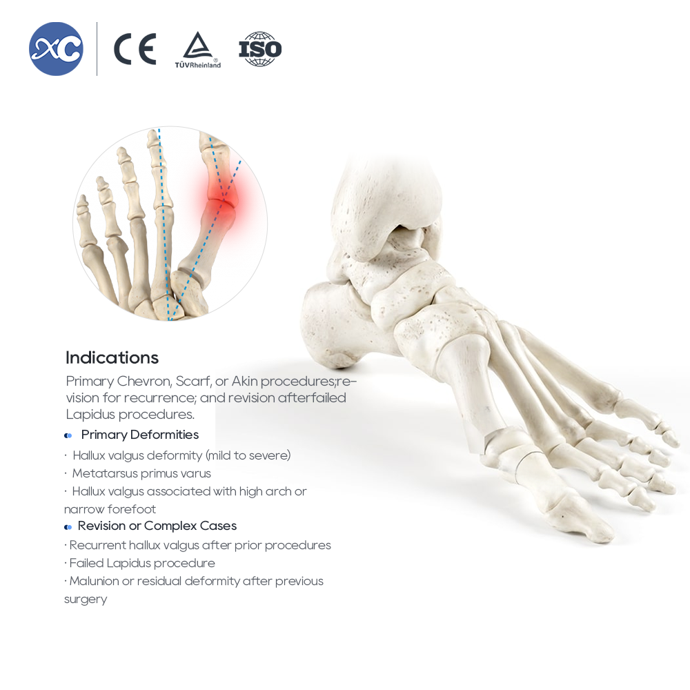 MIS Hallux Valgus Osteotomy Instrument Set