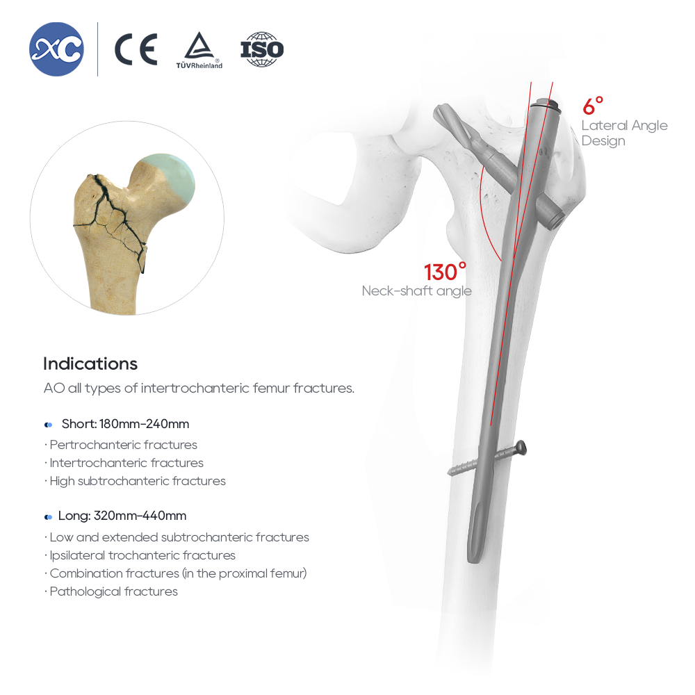 PFNA(Gama) Intramedullary Nail