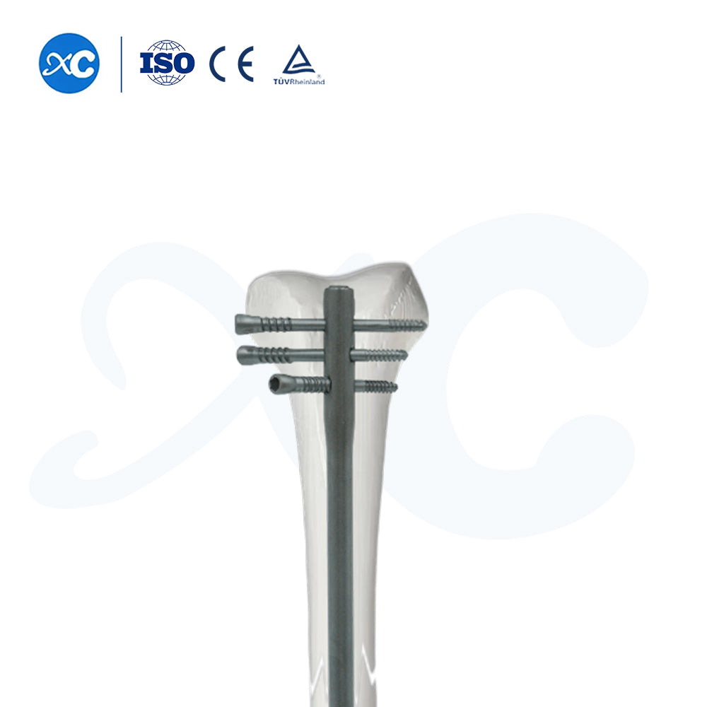4.7mm Locking Screw for Femoral Reverse Intramedullary Nail-II