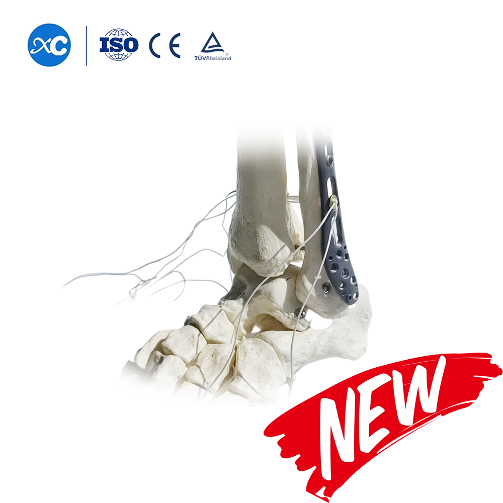 Locking Plate III for Distal Tibiofibular Syndesmosis Ⅲ