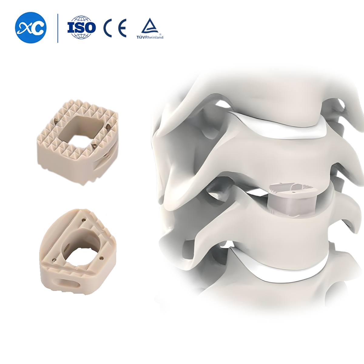 Cervical Peek Cage-II —PEEK Cage