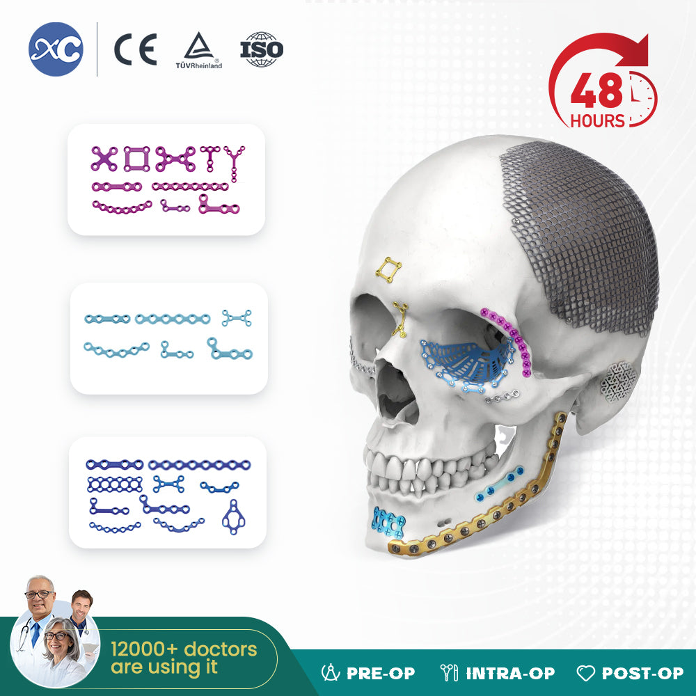 Screw for 2.0mm Maxillofacial Plate (Thickness:1.0mm)