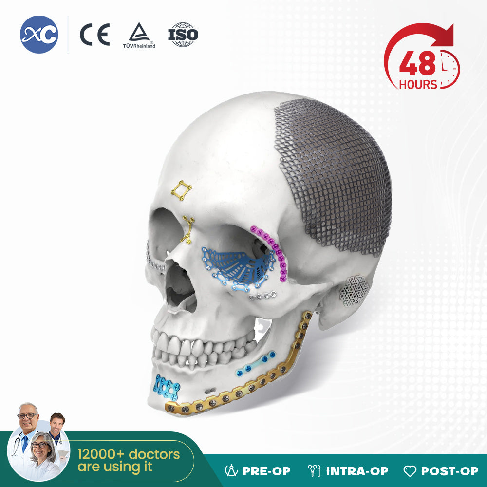 2.4mm Maxillofacial Reconstruction Plate