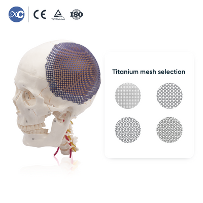 Titanium Mesh (Square Hole & Round Hole & Cloud Shape & Flower Shape)