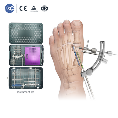 MIS Hallux Valgus Osteotomy Instrument Set