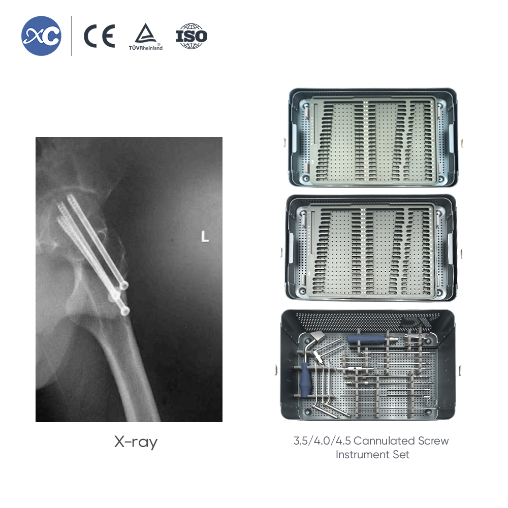 6.5/7.3 Cannulated Screw Instrument Set
