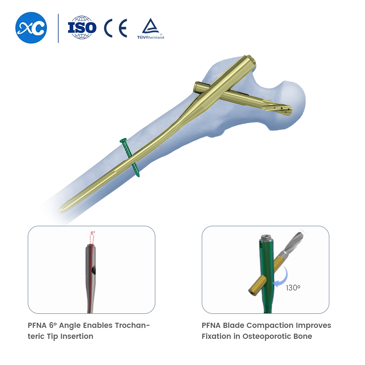 Blade Screw for PFNA(Gama) Intramedullary Nail