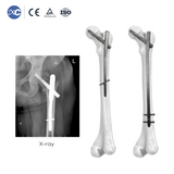 PFNA(Gama) Intramedullary Nail