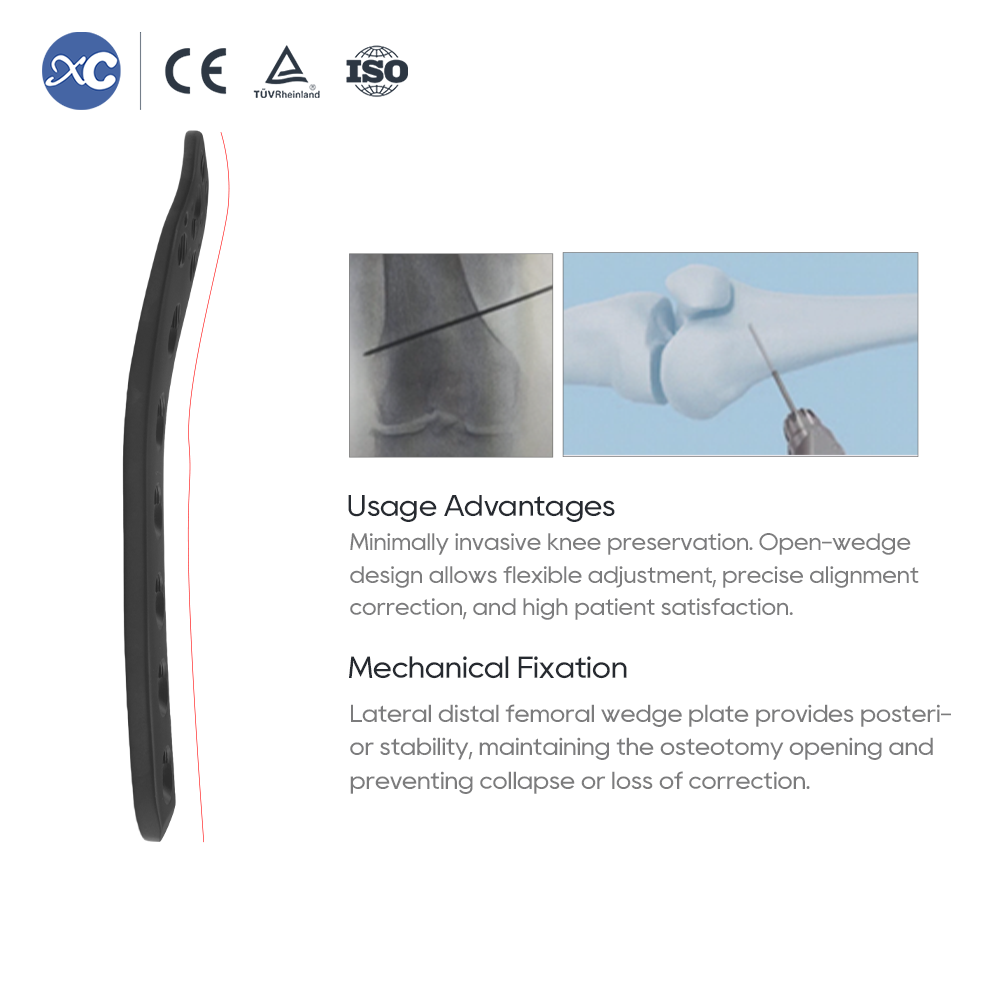 Lateral Distal Femoral WedgeOsteotomy Plate