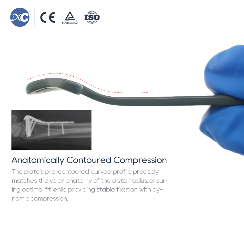 Distal Radius Volar-Multi-axial Locking Plate(withradial tap)
