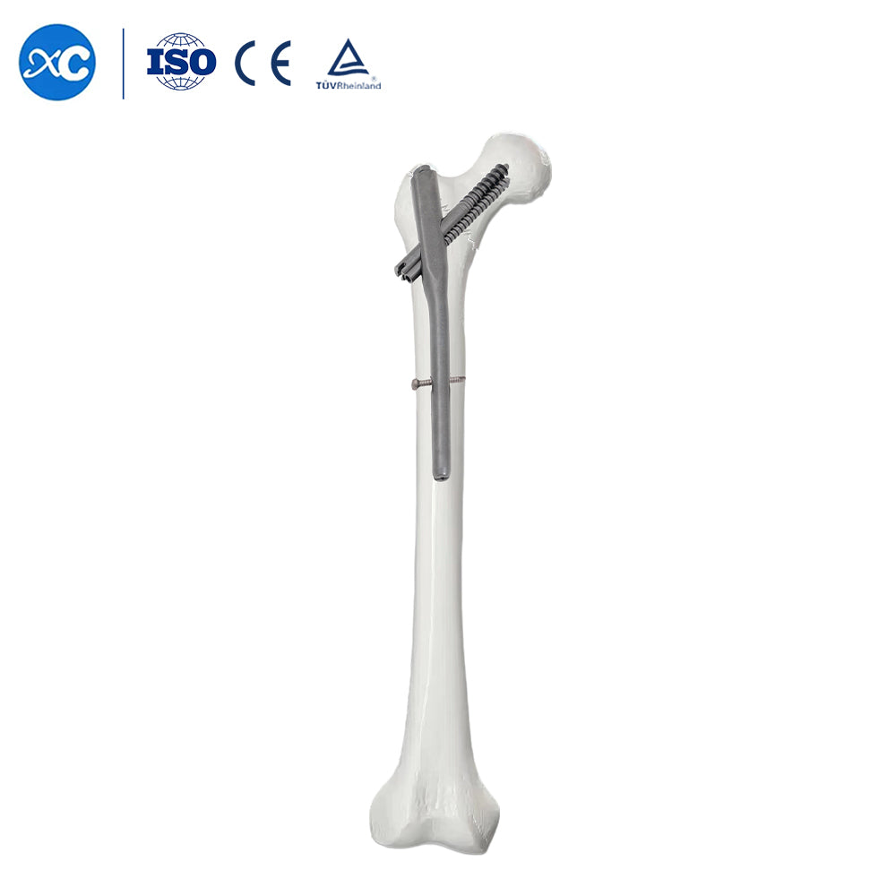 Intertan Nail
