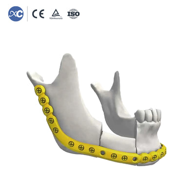 2.4mm Maxillofacial Reconstruction Plate