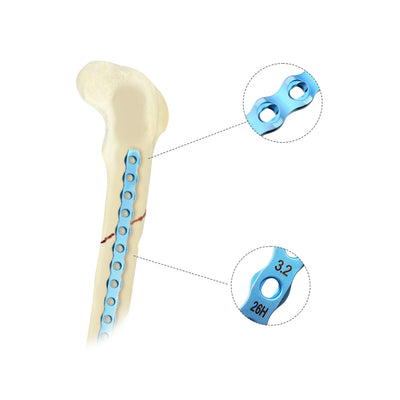 Veterinary 3.2mm ALPS-II Locking Plate for Small Animal Orthopedic Surgery