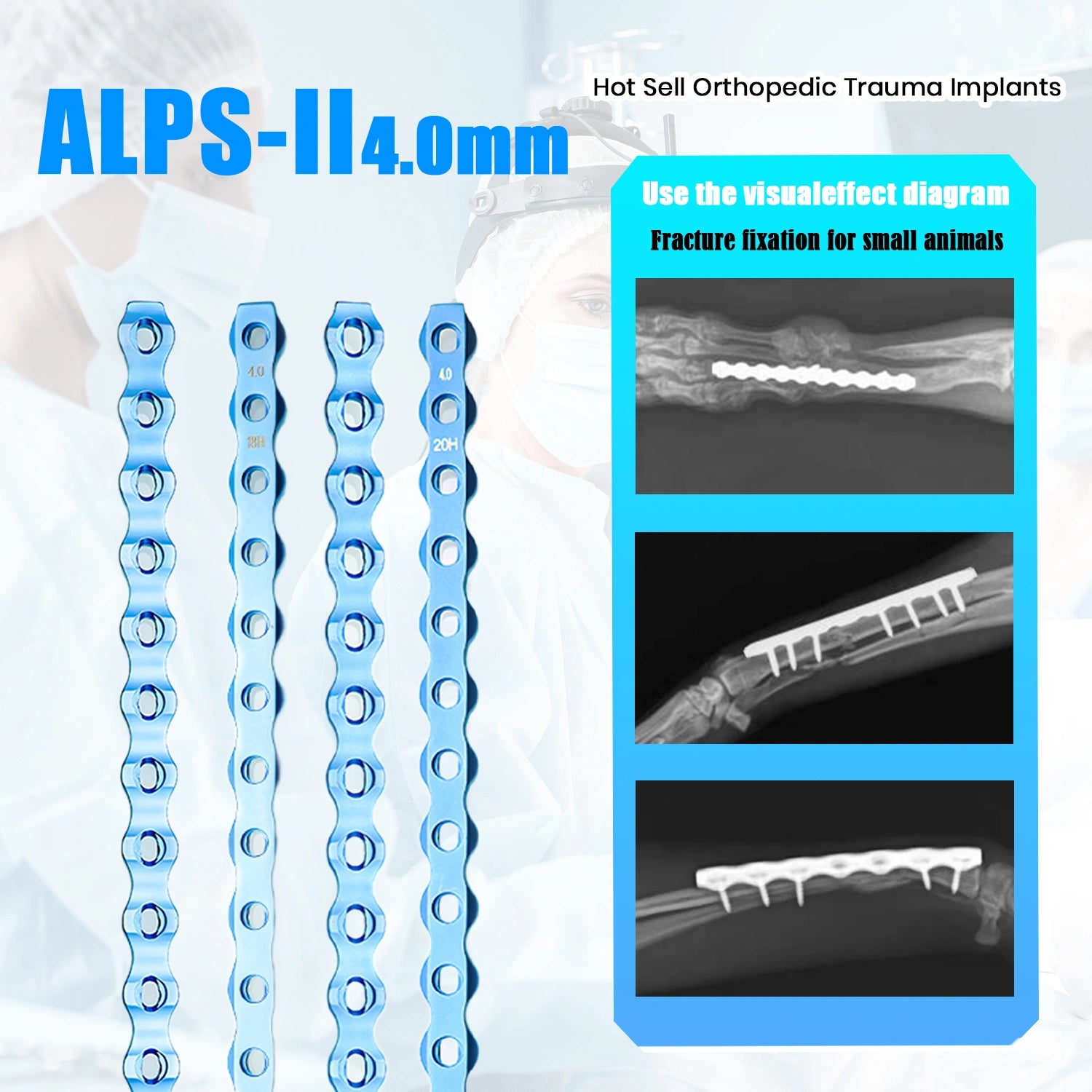 Veterinary 4.0mm ALPS-II Locking Plate for Small Animal Orthopedic Procedures - xcvet.com