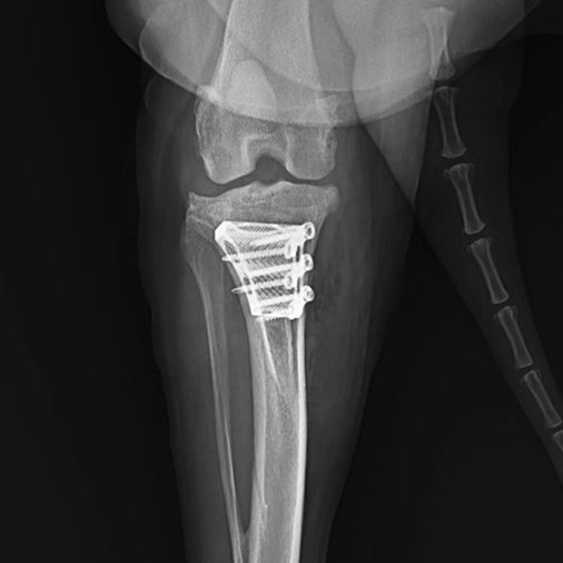 TTA 3D Printed Rapid Surgery