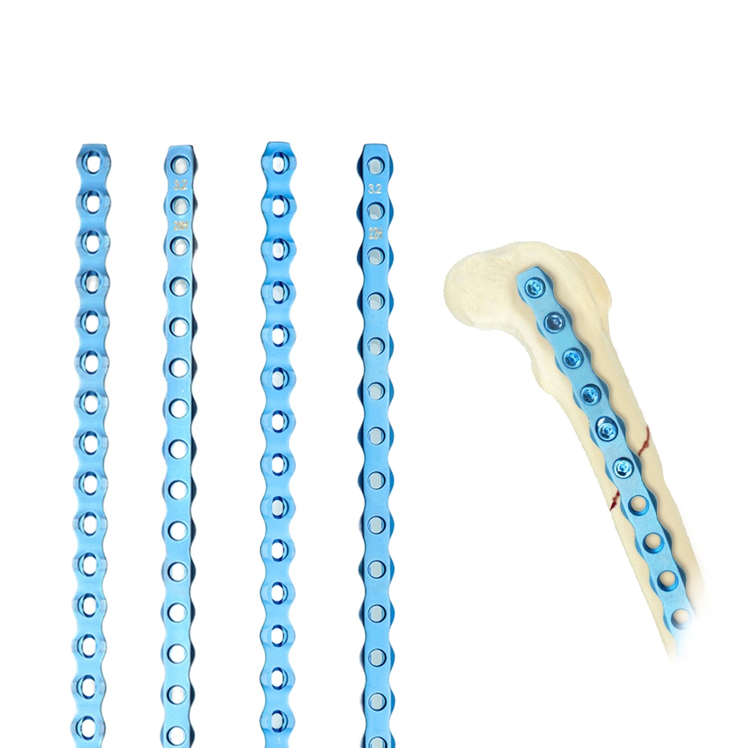 Small Animal Orthopedic Implant 3.2mm Alps Locking Plate for Vet Clinics Surgery