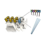 Titanium Veterinary Polyaxial Spinal Screws for All Animal Sizes