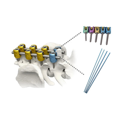 Titanium Veterinary Polyaxial Spinal Screws for All Animal Sizes - xcvet.com