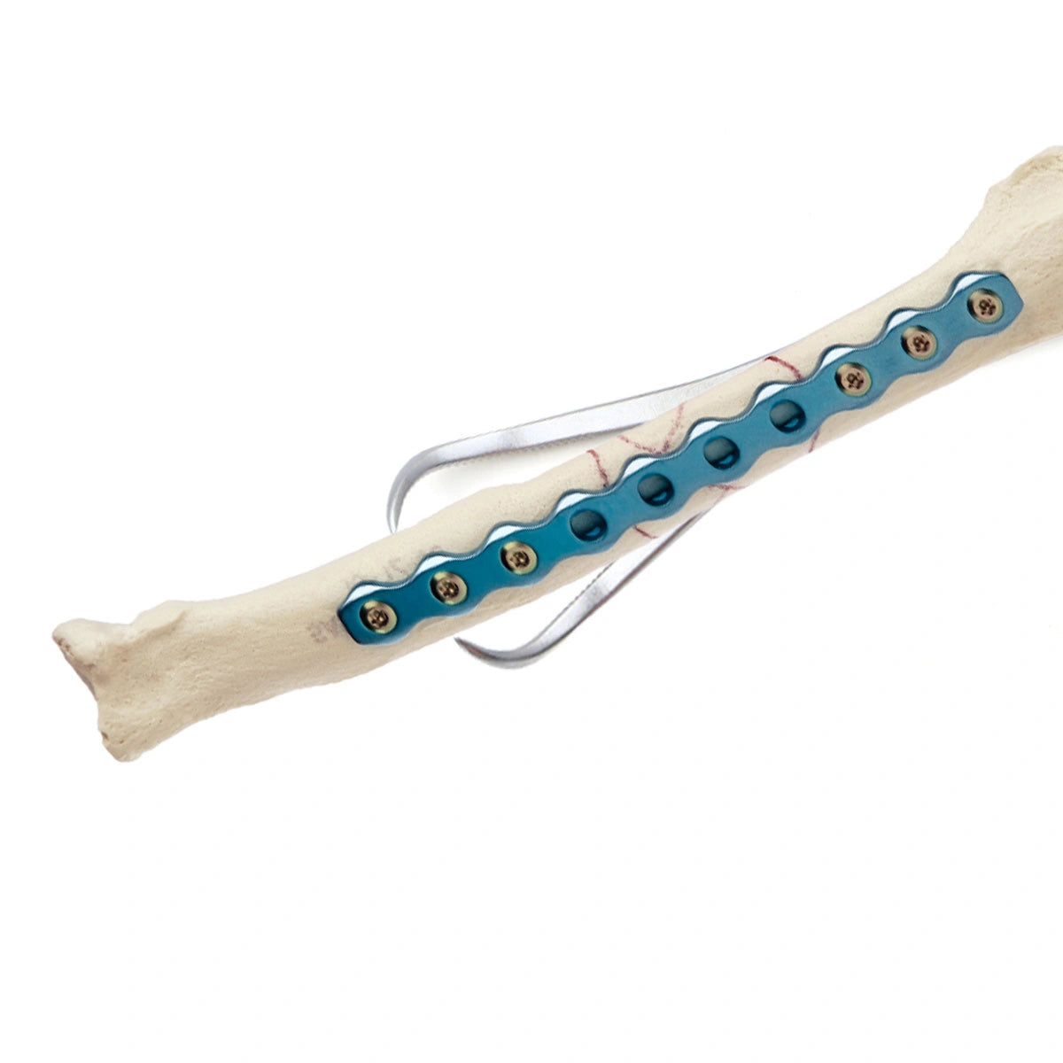 Veterinary Stainless Steel Reduction Forceps with Point – Corrosion Resistant