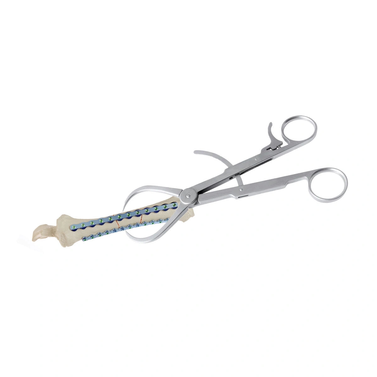 Veterinary Reduction Forceps (Pointed Tip) for Precise Small Animal Orthopedic Surgery